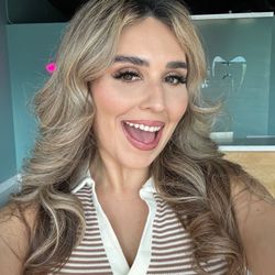 Naturally White Teeth Whitening - Post results