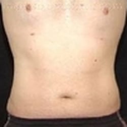 Mark Solomon MD, FACS