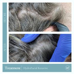 Wesley Chapel Laser and Aesthetics