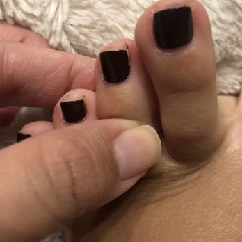 Glossy Nails - More of the dark color on my toes. You can also see that she painted too far up and it's on the cuticle. - Nail Salons Near Me - Rocklin, California