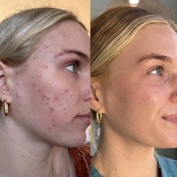 Skin Is Within - Client results