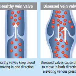 Rose City Vein Center