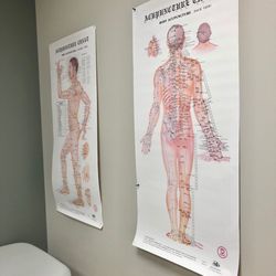 Community Health Pavilion Speedway - They offer acupuncture