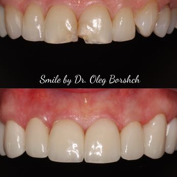 Oleg Borshch, DDS - Cosmetic Dentists Near Me - New York, New York Oleg Borshch, DDS - Cosmetic Dentists Near Me - New York, New York