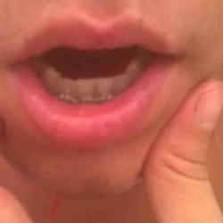 smiledent