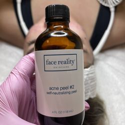 Zerma Aesthetics - Acne Bootcamp facial.