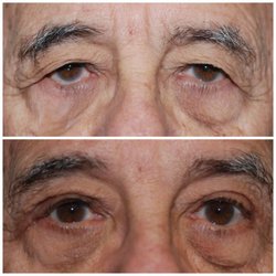 Steven Covici, MD, FACS - Before and After Results from Steven Covici, MD, FACS | Springfield,  MA