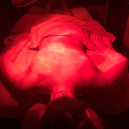 Cupping and some needles under a heat lamp. Bliss!