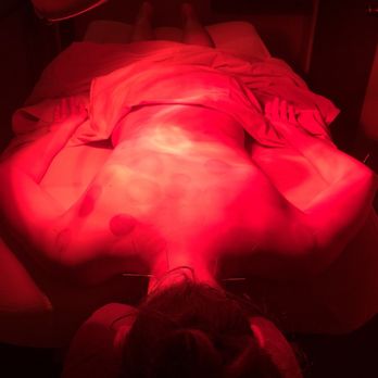 Gaia Acupuncture - Cupping and some needles under a heat lamp. Bliss! - Acupuncture Near Me - Bloomington, Illinois