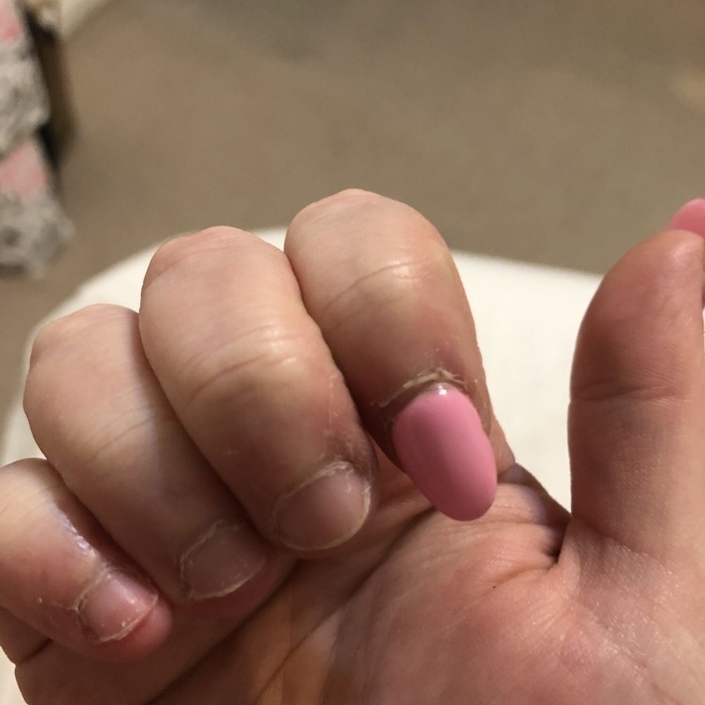 Ivy's Nails & Spa - This is my gel manicure I got 1 week ago, won't be back. - Nail Salons Near Me - Temecula, California Ivy's Nails & Spa - This is my gel manicure I got 1 week ago, won't be back. - Nail Salons Near Me - Temecula, California
