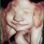 Photo of Already Adorable
