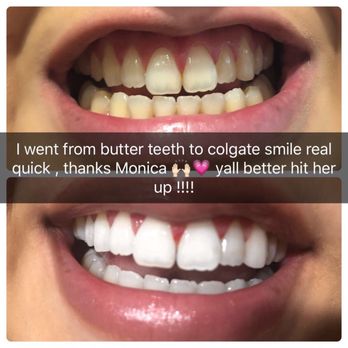 MySmile - Whoa!!! :))) - Medical Spas Near Me - Houston, Texas MySmile - Whoa!!! :))) - Medical Spas Near Me - Houston, Texas