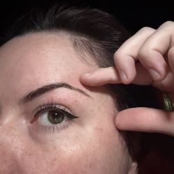 Redness/wounds all around Lower brow few days later