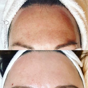 Skinnovation - We can help with with sun damage - Skin Care Near Me - San Francisco, California Skinnovation - We can help with with sun damage - Skin Care Near Me - San Francisco, California