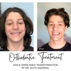 Newport-Mesa Orthodontics & Family Dentistry - A smile makeover that transforms kids and teens, boosting confidence, happiness, and creating the best version of themselves!