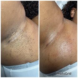 BeautyNStylesByJade - Before and after underarm wax