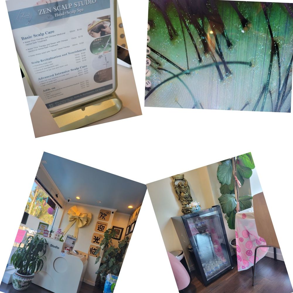 Zen Scalp Studio - Hair Loss Centers Near Me - Burlingame, California