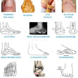 University Foot and Ankle Specialists