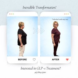 Svelte Medical Weight Loss Centers - GLP before-and-after