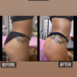 Blissful Bodies - Buttock vacuum enhancement offered.