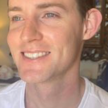 Lux Aesthetic Medical Services - about 30 minutes after i finished my facial - Medical Spas Near Me - Allen, Texas