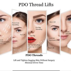 Aging Younger - Facial thread lifting