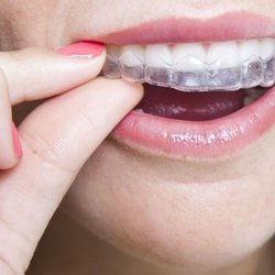 Cosmo Haralambidis, DMD-Cranston Orthodontics - We offer clear aligner options.