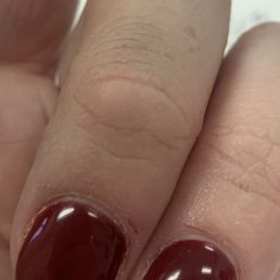 2 cuts on my fingers and cuticles not cut 2 cuts on my fingers and cuticles not cut