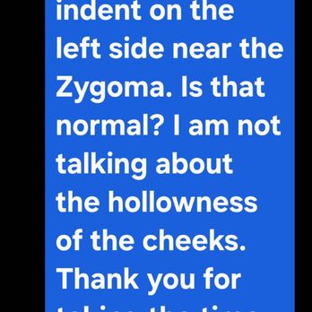Injx By Nat - Medical Spas Near Me - Cranford, New Jersey