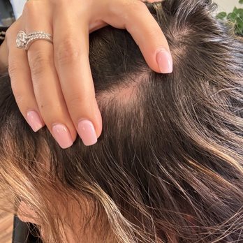 Top Knot Salon - bald spot healed - Hair Salons Near Me - Loveland, Colorado Top Knot Salon - bald spot healed - Hair Salons Near Me - Loveland, Colorado