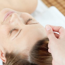 Meridian Medicine Acupuncture Clinic - Most patients find the acupuncture session very relaxing.