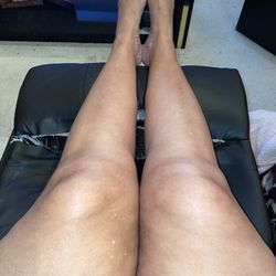 Tuesday morning less than 24 hours after treatment