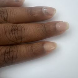 Before brittle nails
