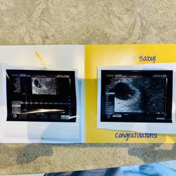 Reproductive Fertility Center - Photo of our baby so excited that it worked the first time