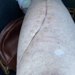 The Law Office of Charles Anderson Jr - The scar I am left with