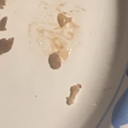 Bone fragments i bit into. Bone fragments i bit into.