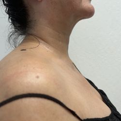 Her Contour & Wellness - Facial surgery-lymphatic massages