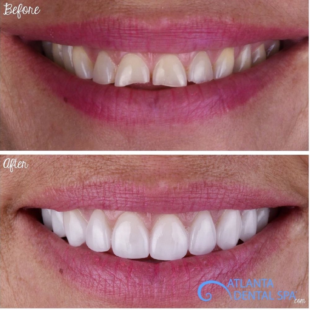 ATLANTA DENTAL SPA 31 Photos & 21 Reviews 664 N Highland Ave NE