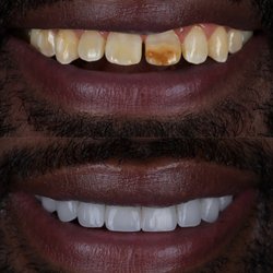 Playa District Dental