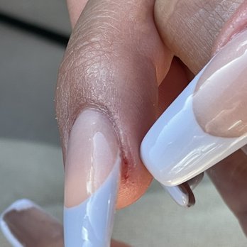 Glossi Nail Bar - depth of cut from my nail tech being rough and careless. - Nail Salons Near Me - Colma, California