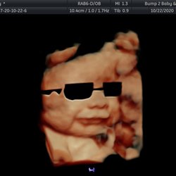 Bump 2 Baby & Beyond