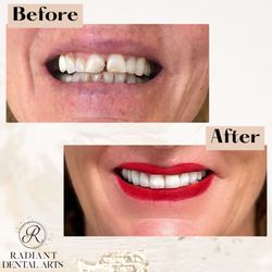 Radiant Dental Arts - Check out this smile makeover!
Call to schedule a consultation today!