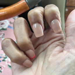 Cut cuticles! Fingers in pain!