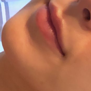 Be Beautiful Aesthetic Medicine - This is after - Medical Spas Near Me - Miami, Florida Be Beautiful Aesthetic Medicine - This is after - Medical Spas Near Me - Miami, Florida