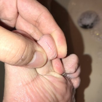 Chic Nail & Spa - It's looks small...but it freakn hurts!!! Not to mention how unsanitary this could be!!! - Nail Salons Near Me - Federal Way, Washington Chic Nail & Spa - It's looks small...but it freakn hurts!!! Not to mention how unsanitary this could be!!! - Nail Salons Near Me - Federal Way, Washington