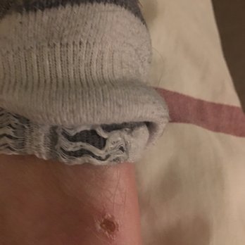 Fiji Nails & Spa - After girl used pumice stone at Fiji nails in Havertown - Nail Salons Near Me - Havertown, Pennsylvania Fiji Nails & Spa - After girl used pumice stone at Fiji nails in Havertown - Nail Salons Near Me - Havertown, Pennsylvania