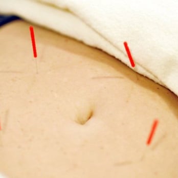 Kokin Healing Center - Acupuncture Near Me - Calabasas, California Kokin Healing Center - Acupuncture Near Me - Calabasas, California
