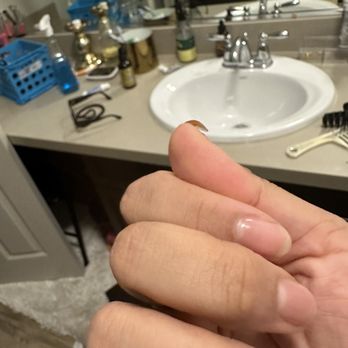 ProTop Nails - 1 week later. - Nail Salons Near Me - Roseville, California