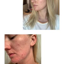 Skintherapy Skincare & Acne Clinic