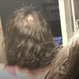 The bald spot on the back of my head because so much of my hair was parted incorrectly before it was cut